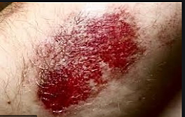 When I feel of the motor bike