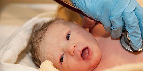 24 HORAS DE NACIMIENTO