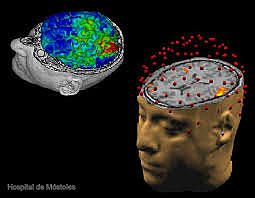 CARTOGRAFÍA CEREBRAL