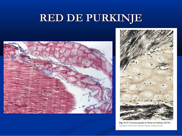 FIBRAS DE PURKINJE