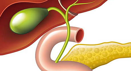 NECESIDAD DE LA BILIS