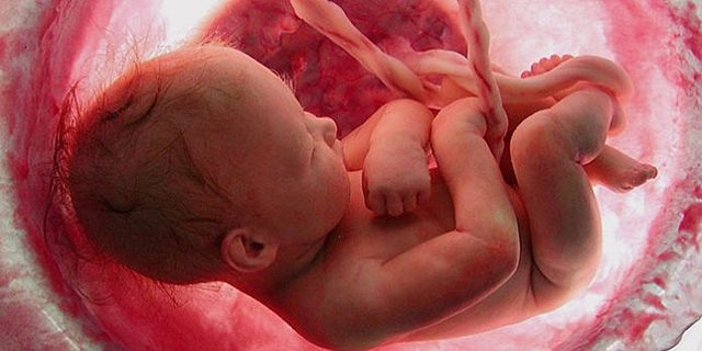 Birth - Third Trimester