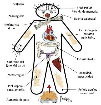Freud, Angosto, T. Entre otros