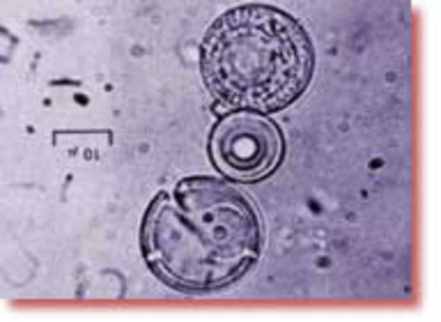 (1912-1998) Sidney Fox