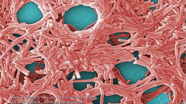 DESCUBRIMIENTO DE LA LEGIONELLA