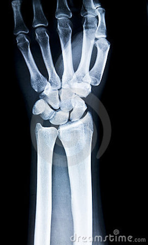 El Descubrimiento de Rayos X