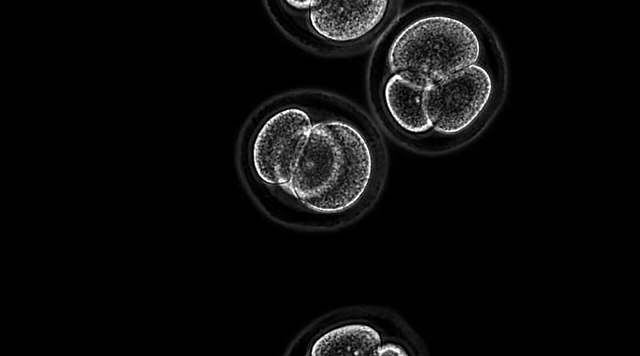 Células  Madre a partir de células de la piel