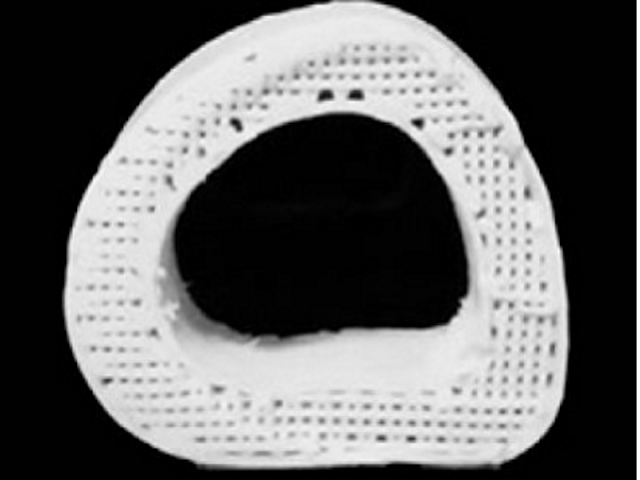 Huesos artificiales en Impresora 3D