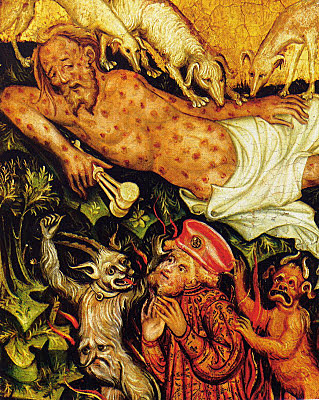 Decretos Levíticos  Lepra