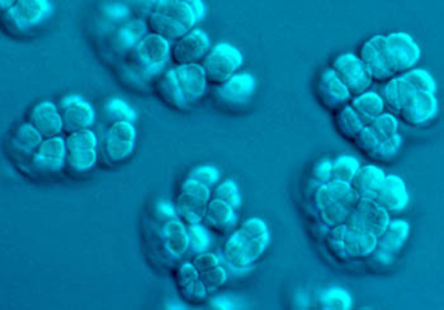 (4 BYA) Archaea Bacteria