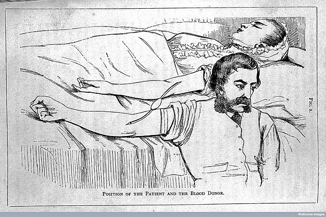 First blood transfusion performed