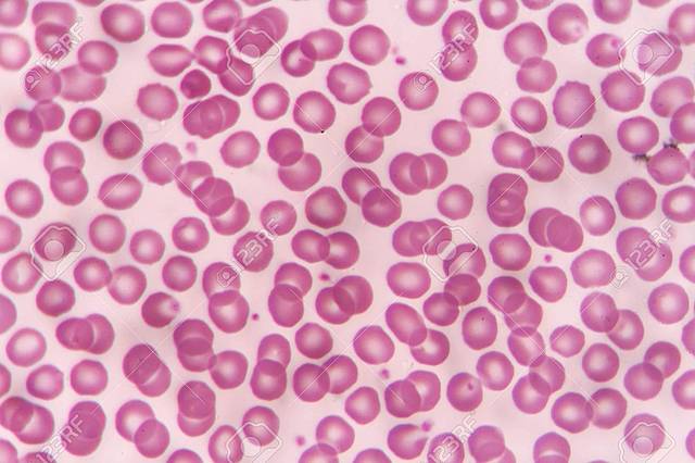 Anton van Leeuwenhoek viewed blood cells under a microscope