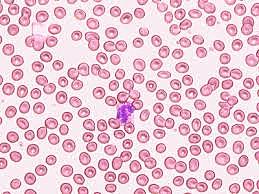Blood Cells Under Microscopes