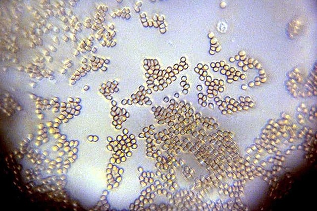 Leeuwenhoek discovered animalcules