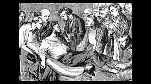 Anestesia / William Morton