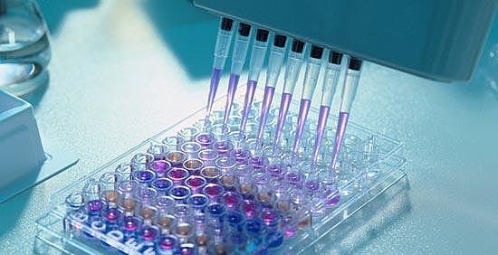 Development of ELISA test to screen for diseases such as HIV