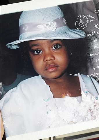 DESAGRADO A LAS COSAS VISCOSAS