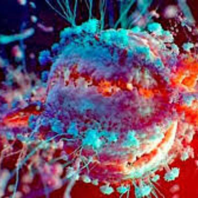 Timeline: La historia del VIH+