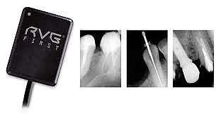 RadioVisografía de Trophy Radiology