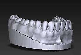 3D/Dental