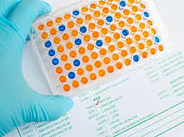 Development of ELISA test