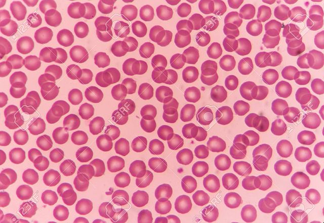 Anton van Leeuwenhoek viewed blood cells under a microscope