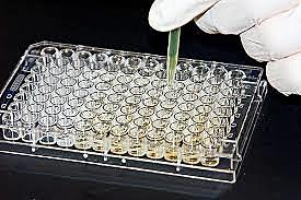 ELISA Test
