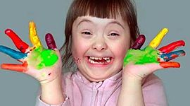 Timeline: Historia de la Discapacidad Intelectual