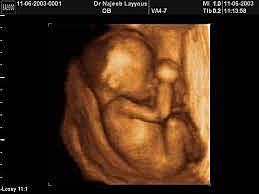 sixth month in the womb