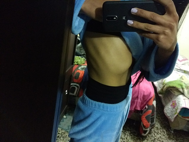 Trastorno alimenticio