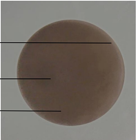 Oocito sin fertilizar