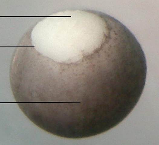 Gástrula temprana o labio dorsal