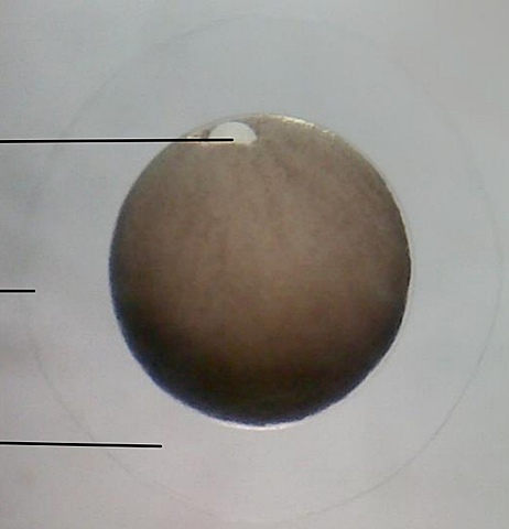 Gástrula media o labio ventral