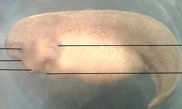 Contracción muscular