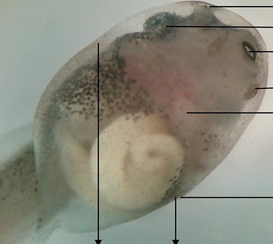 Cierre del opérculo derecho