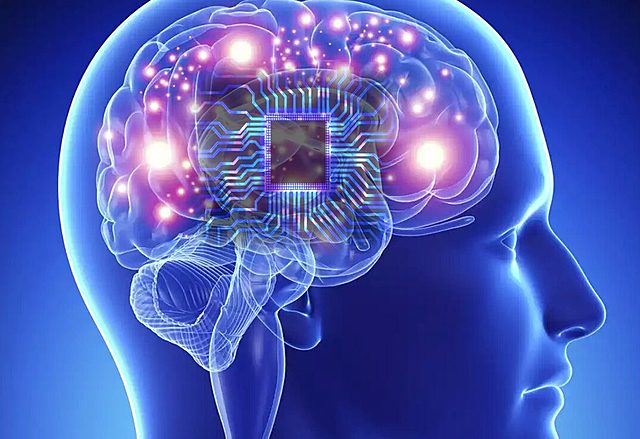 Implantes de memoria