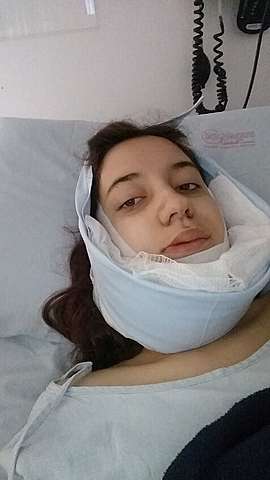 My orthognathic surgery