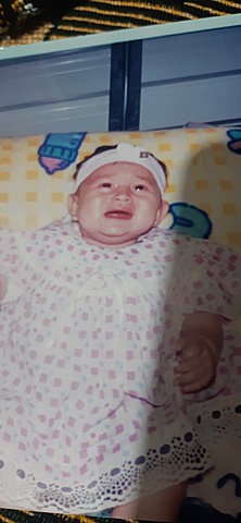 Detectación de desviación de cadera