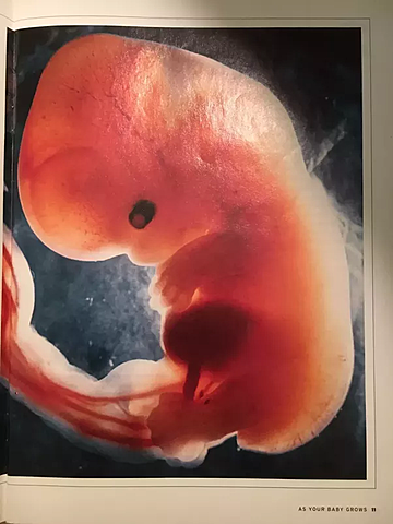 Month 2; Trimester 1