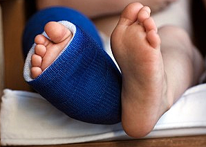 Fractured Foot