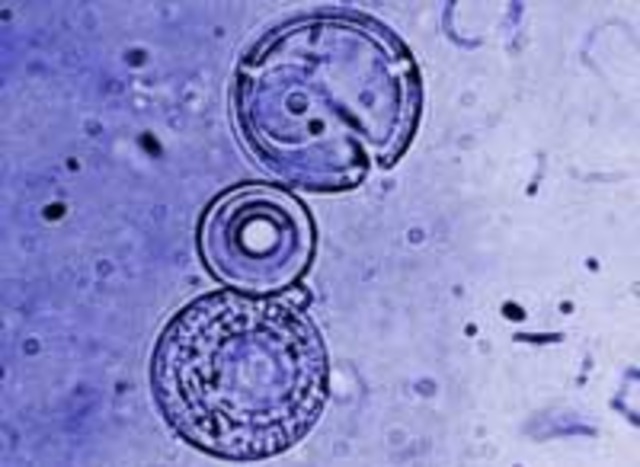 (1912-1998) Sydney Fox