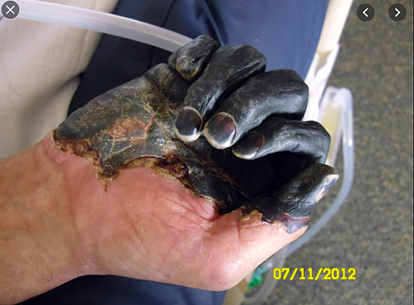 Bubonic Plague begins