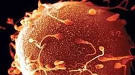 Timeline: A Pregnant Woman