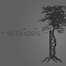 getting diagnosed with scoliosis