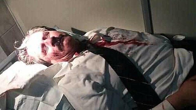 Agreden a Albarracín y él llama a “resistencia civil”