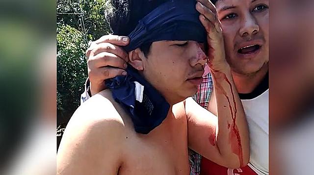 Al menos cinco heridos tras enfrentamientos en el municipio El Torno en Santa Cruz