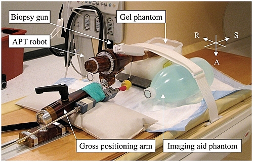 Robotic Assisted Biopsy