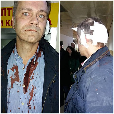 Anti-government Demonstrations in Serbia