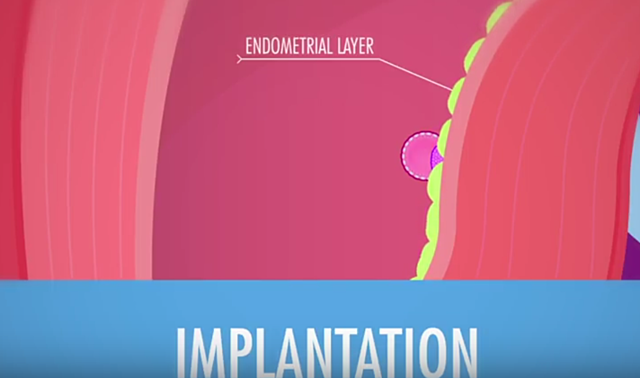 Implantation