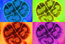 Deinococcus radiodurans